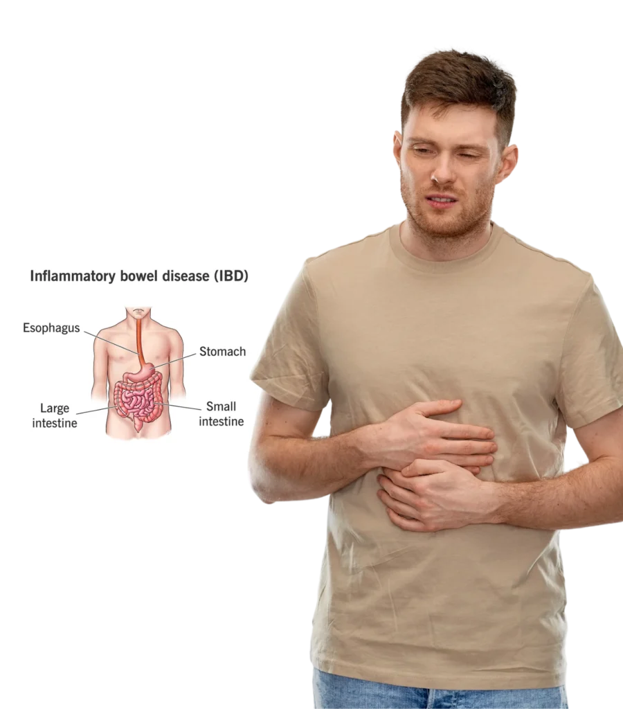 Inflammatory Bowel Disease Treatment in Hyderabad