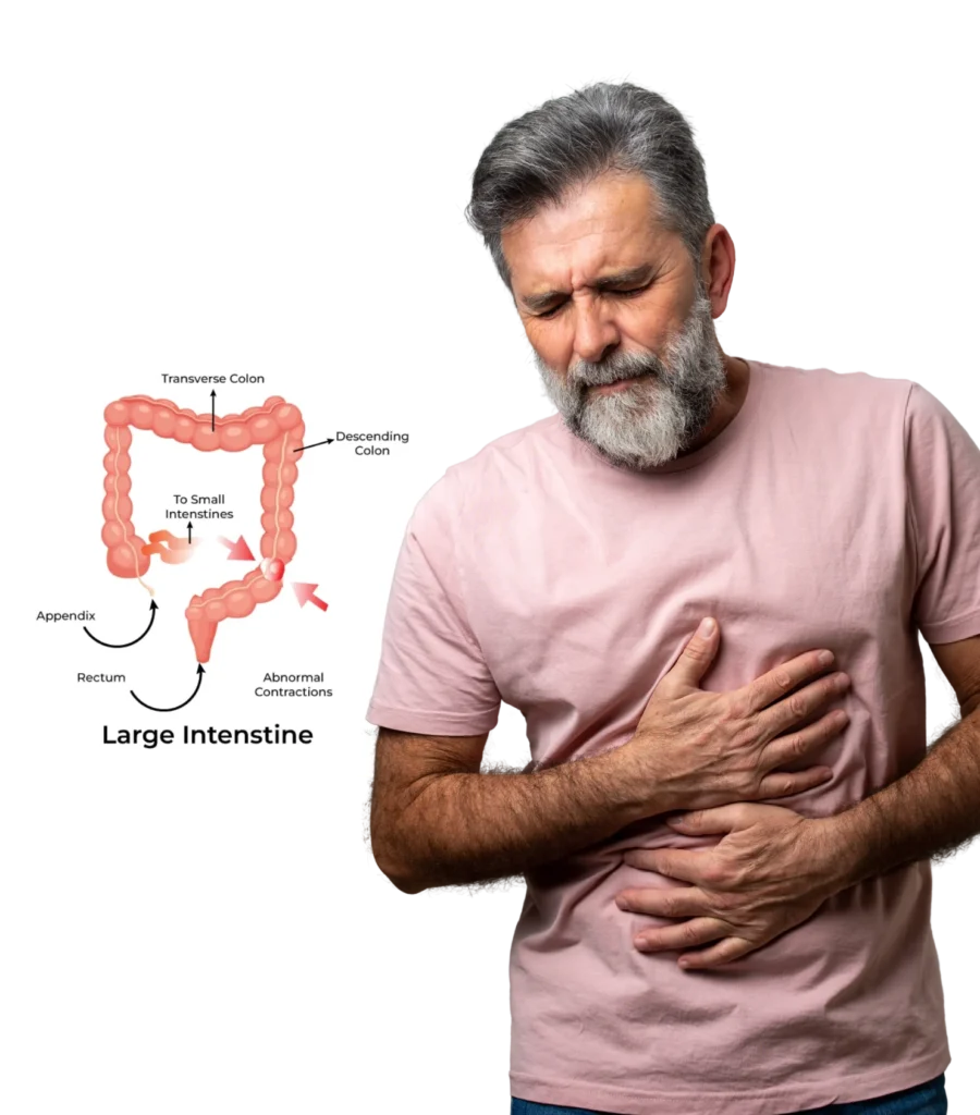 Best Irritable Bowel Syndrome Treatment in Hyderabad