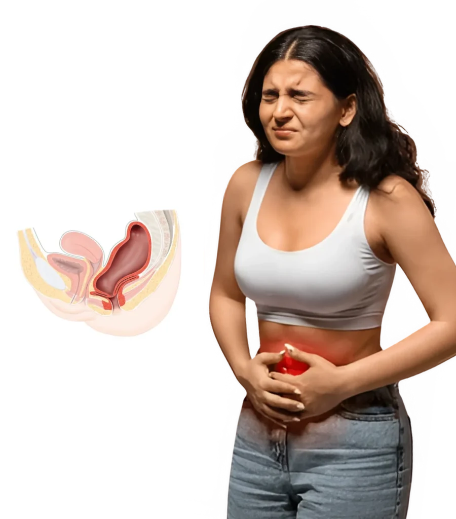 Obstructive Defecation Syndrome Treatment in Hyderabad