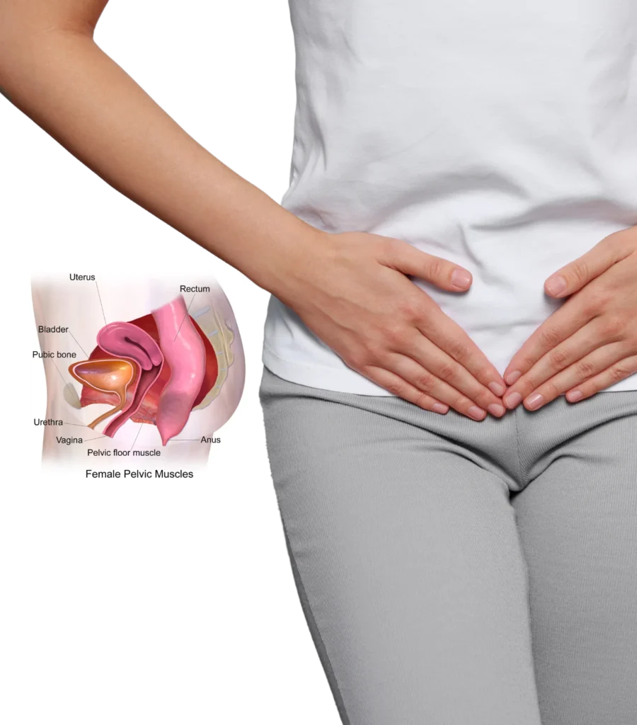 Best Pelvic Floor Dysfunction Treatment in Hyderabad
