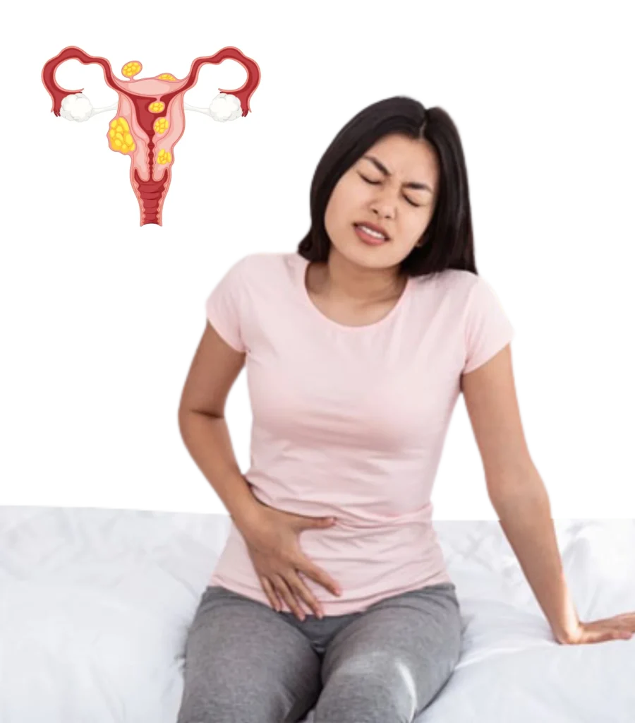 Myomectomy surgery being performed by expert gynecologists at Lux Hospitals in Hyderabad